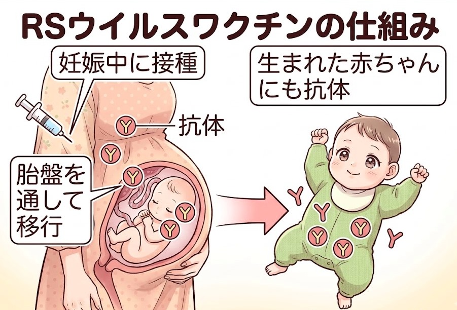 【2026年4月開始】RSウイルス母子免疫ワクチン(アブリスボ)打つべき?無料化(定期接種)!新生児専門医がNICU目線で解説