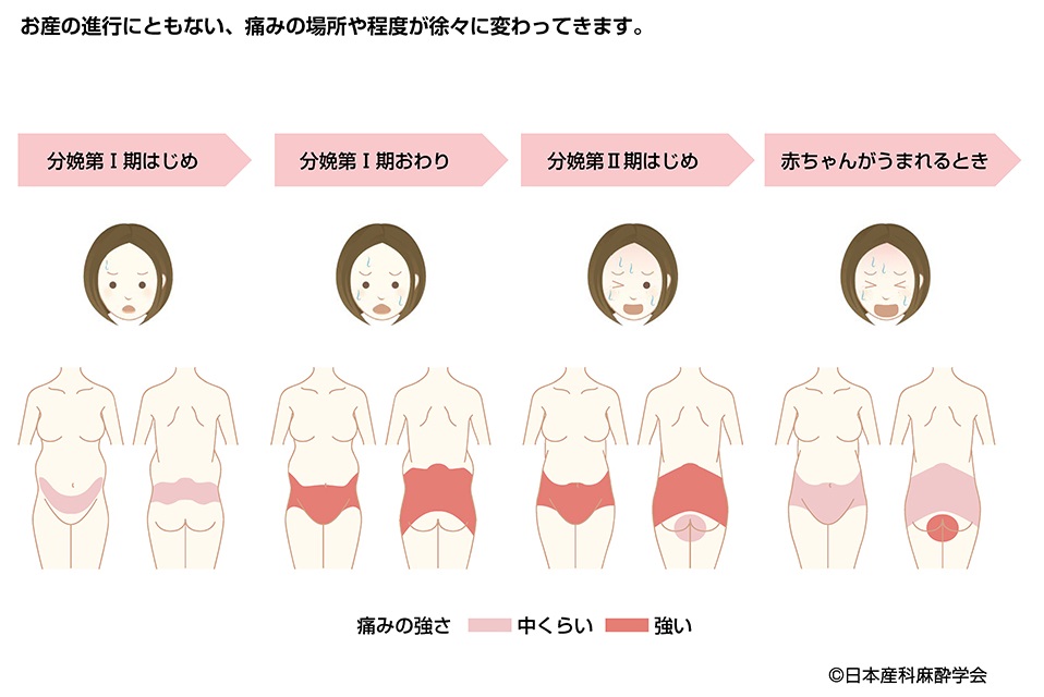 産科医が違和感を覚える「陣痛は鼻からリンゴ」説〜なぜ出産の痛みは珍妙な例えで語られ続けてきたのか？〜